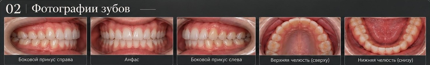 Фотографии зубов: примеры необходимых ракурсов